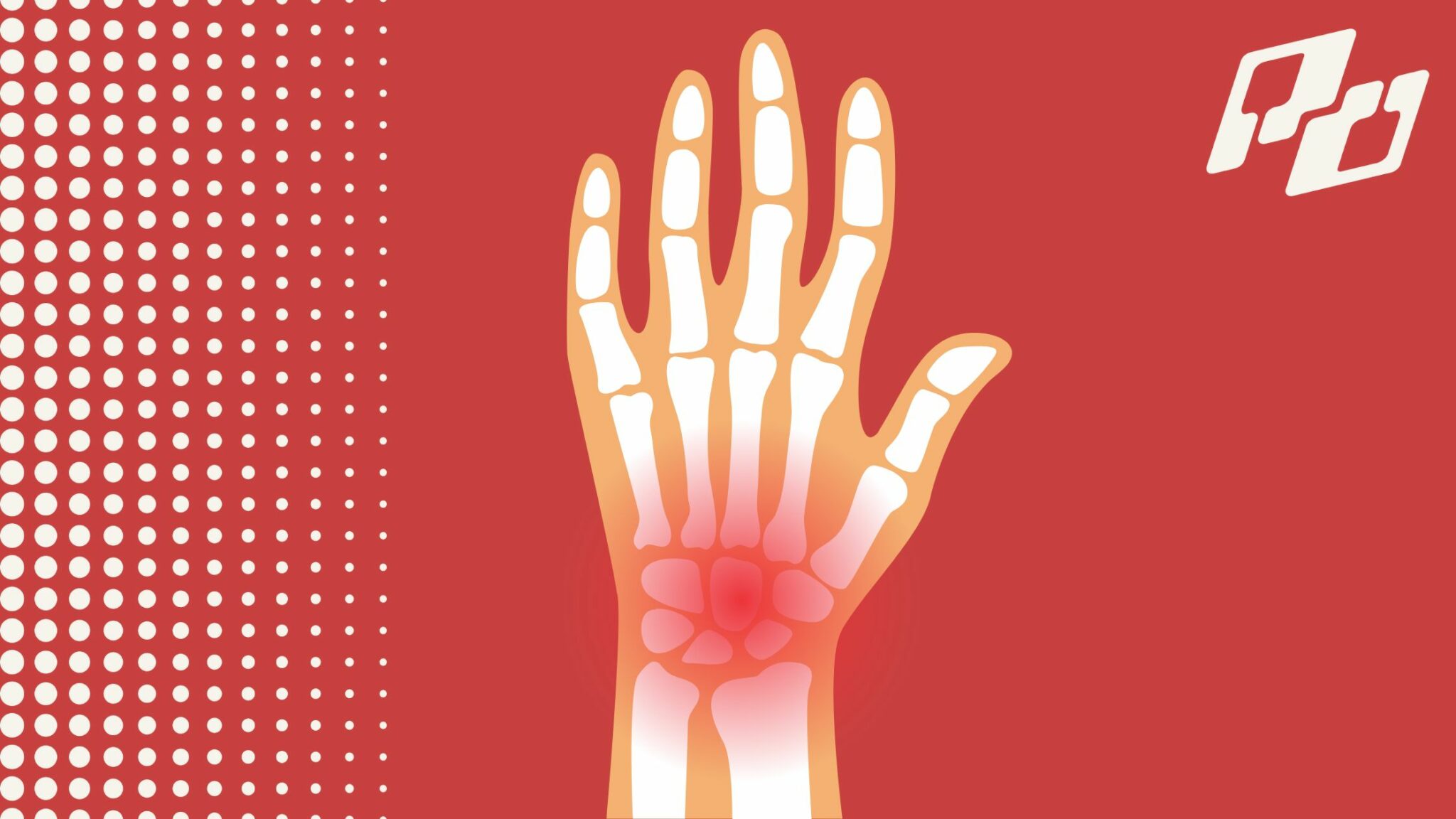 wrist pain pickleball players