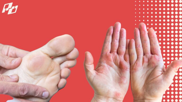 How to Prevent Blisters in Pickleball (Hands, Toes, and Everything in Between) How to Prevent Blisters in Pickleball Hands Toes and Everything in Between 1